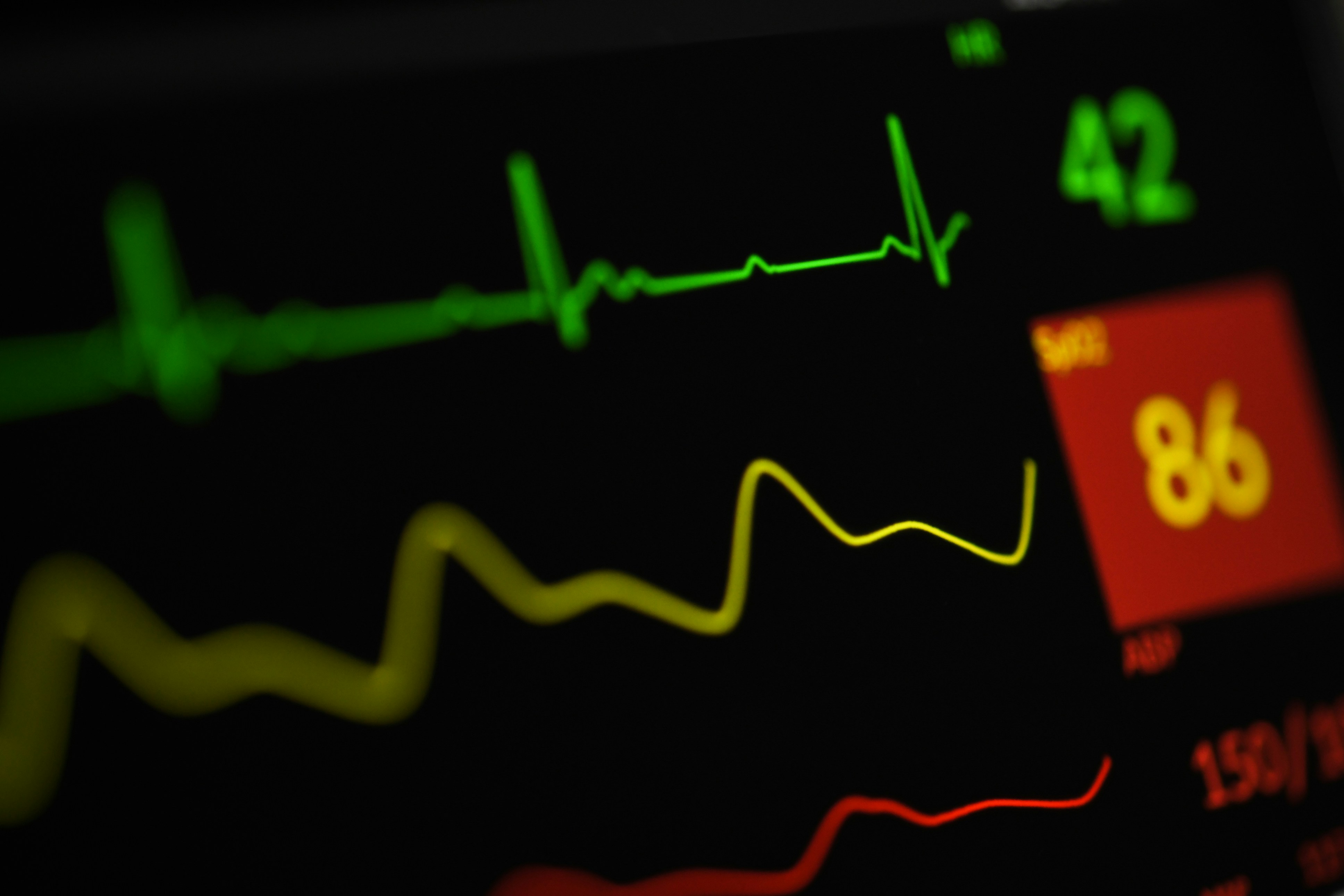 Smartwatch measuring heart rate